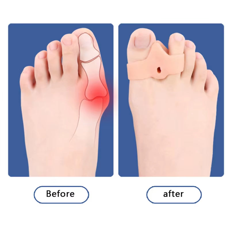 Hallux Valgus Corrector Foot Adjuster Care Silicone Toe Separator Pain Relief Foot Feet Straightener Overlapping Toe Separator